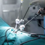 Réparations d'instruments chirurgicaux 4 Réparations d'instruments chirurgicaux